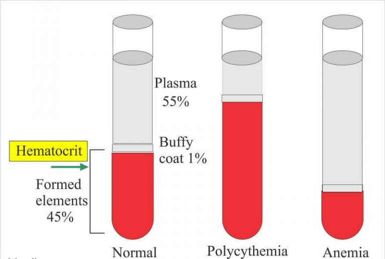 Hematocrit là gì? Quy trình xét nghiệm Hematocrit